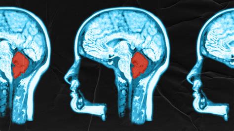 The Cerebellum Structure Position Vasculature, 50% OFF