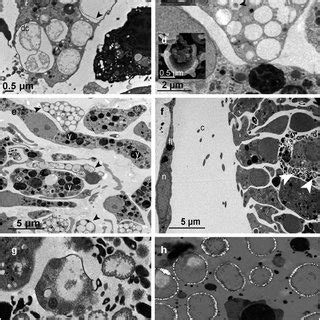 Ultrastructure images of Hemimycale columella tissues from adults and... | Download Scientific ...