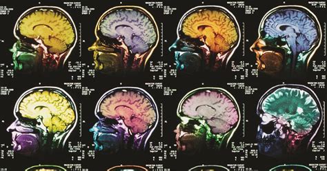 New MRI contrast agents | Feature | Chemistry World