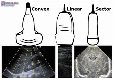 Ultrasound Technique