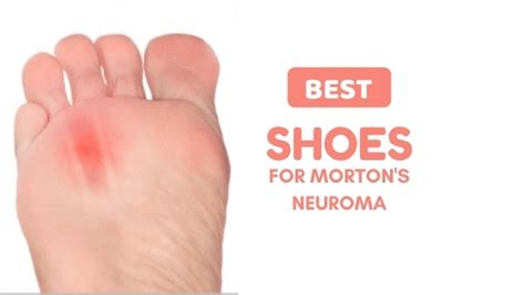 Best Shoes For Morton's Neuroma To Buy In 2020: For Extreme Relief - Voy-Voy