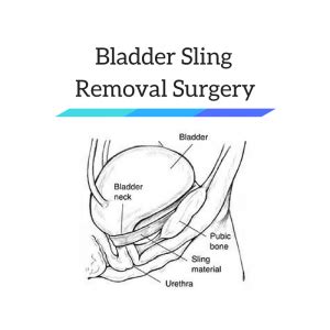 Bladder Sling Removal Surgery - Risk & Complications