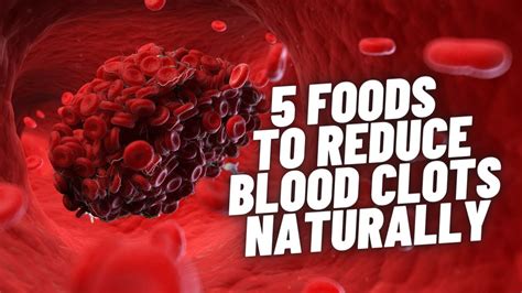 5 Foods that Reduce Blood Clots - Health & Fitness - YouTube