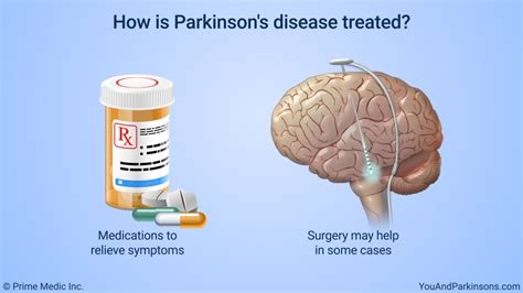 Pin on Animated Parkinson's Patient