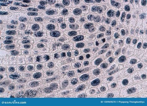 Onion Root Tip Microscope Lab