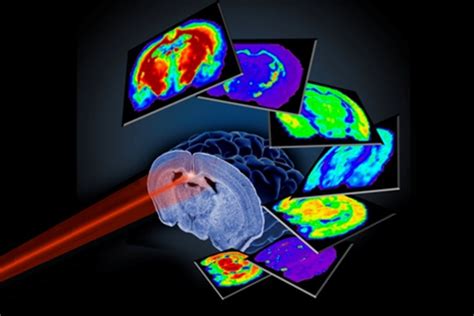 Archive | imaging mass spectrometry | Vanderbilt University