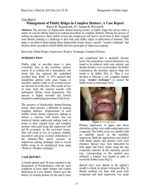 Case Report - Complete Denture - 2 | PDF | Dentures | Medicine