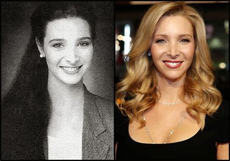 Lisa Kudrow Nose Job