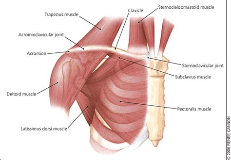 Clavicle fractures • LITFL • Trauma Library