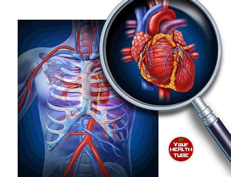 Cardiovascular Disease Symptoms Causes Types Risk Fac - vrogue.co