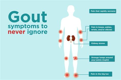 Gout Symptoms You Might Be Ignoring – CreakyJoints