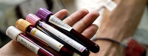 Urea and Electrolytes Blood Test - Update - www.MedicalTalk.Net the Best Medical Forum for ...