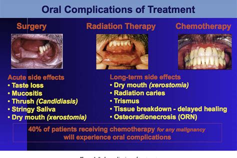 Dental treatment planning and management for the mouth cancer patient. | Semantic Scholar