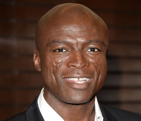 Singer Seal's Face Scars: What Happened & Caused It? Was He Burned?