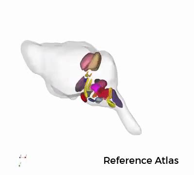 Neuroimage Analysis