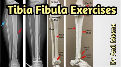 tibia fibula fracture exercises | tibia fracture recovery exercises | tibia fracture ...