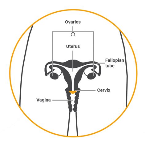 Diaphragms and caps - Umbrella Health