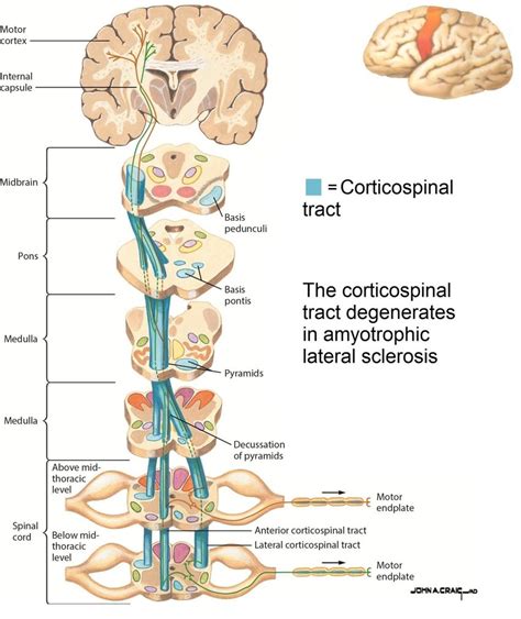 Corticospinal tract (blue) conveying motor signals from motor cortex to ...