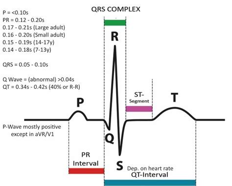 PQRS Complex | Pr interval, Nurse study notes, Medical school essentials