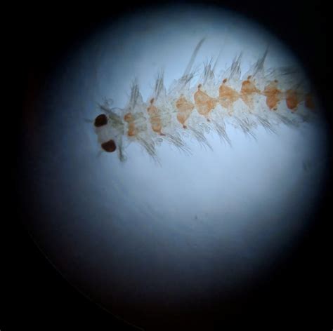 Worm? W/ Microscope Pics | REEF2REEF Saltwater and Reef Aquarium Forum