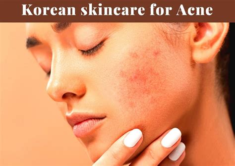 I Reviewed 8 Amazing Korean Skincare Products For Acne 2023 - Korea Truly