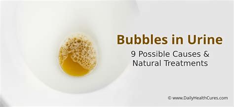 Bubbles in Urine: 9 Possible Causes and Natural Treatments