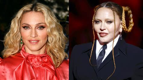 What Did Madonna Do to Her Face? Her Before and After Photo, Explained