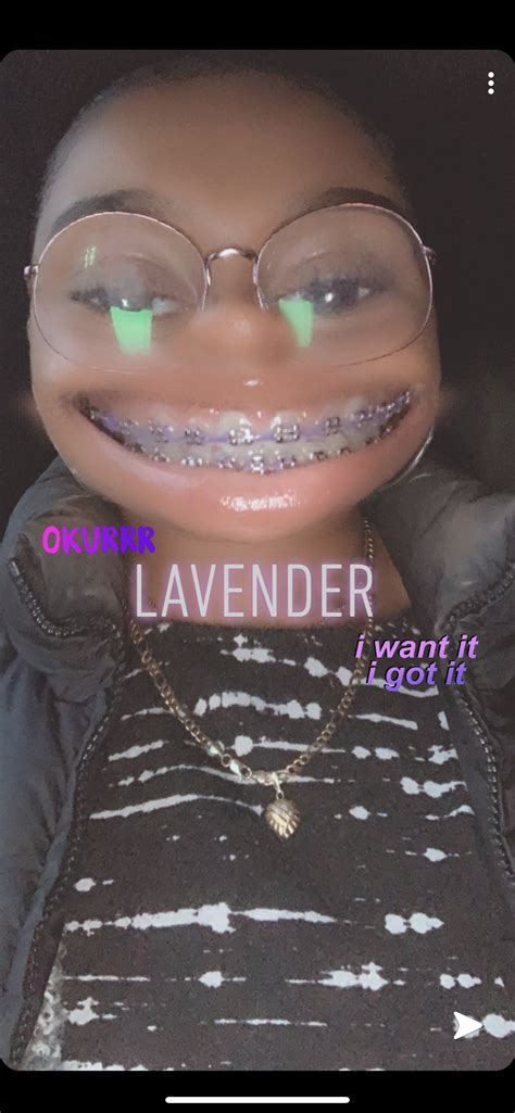 √ Lavender Braces Color