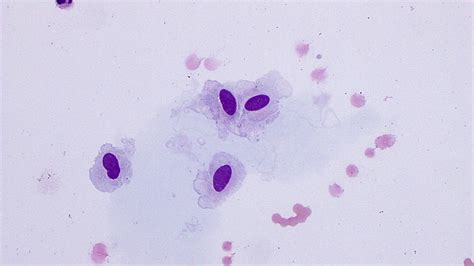 Cerebrospinal fluid | eClinpath