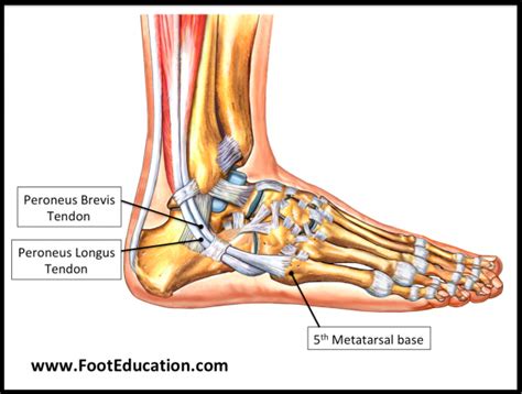 Flexor Hallucis Longus Tendon Transfer to the Peroneus Brevis - FootEducation