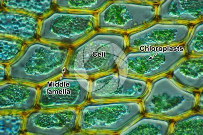 Chlorophyllous parenchyma (Chlorenchyma) - Parenchyma - Plant tissue - Plant histology - Photos