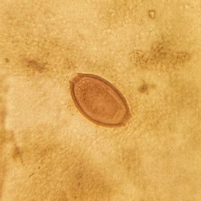 Trichuris Trichiura Egg In Human Feses Seen Under Microscope Stock Photo - Download Image Now ...