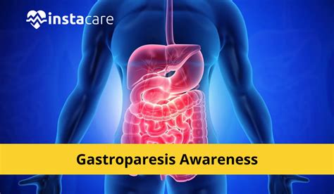 Gastroparesis: Symptoms, Causes, Complications and Diagnosis