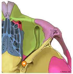 Anterior clinoid process - e-Anatomy - IMAIOS