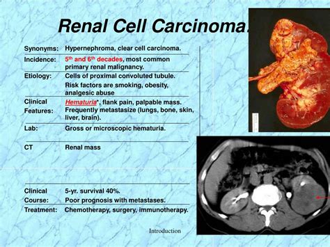 PPT - Anatomy-Kidney PowerPoint Presentation - ID:201308