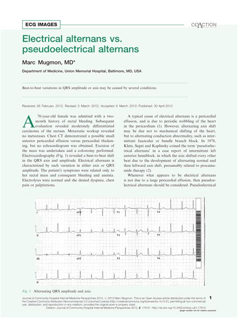 (PDF) Electrical alternans vs. pseudoelectrical alternans