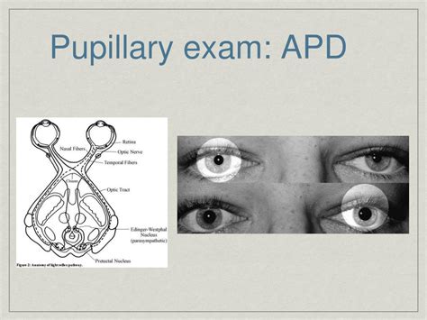 PPT - The Basic Eye Examination PowerPoint Presentation, free download - ID:3699982