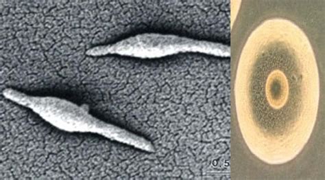 Habitat and Morphology of Mycoplasma pneumoniae