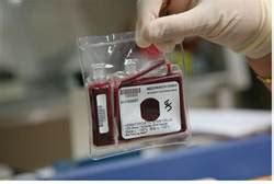 Umbilical Cord Blood Donations » Brusko Laboratory » College of ...