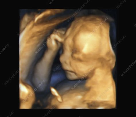 Foetus at 20 weeks, 3D ultrasound scan - Stock Image - C038/8813 - Science Photo Library