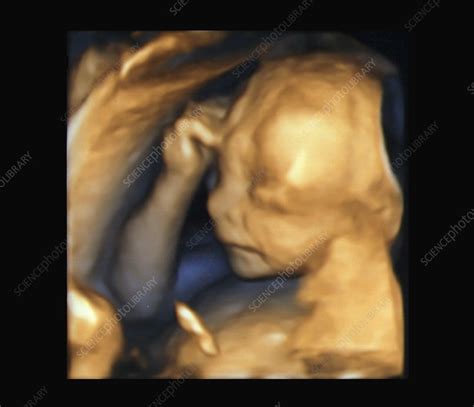 Foetus at 20 weeks, 3D ultrasound scan - Stock Image - C038/8813 - Science Photo Library