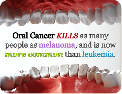 Oral Cancer - Sonoma County Family Dental