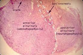 neurohypophysis - Google Search | Histology slides, Anterior pituitary ...