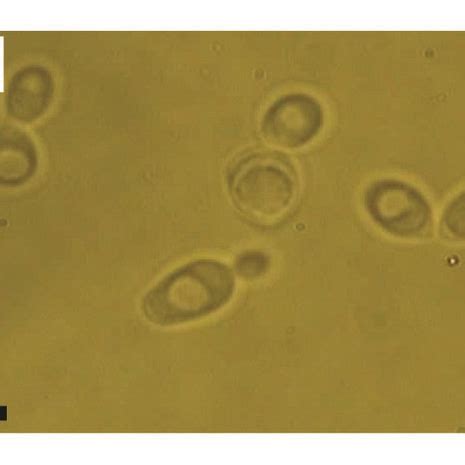 The morphology of the spheroplast W303 cells inside four different... | Download Scientific Diagram