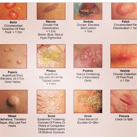 skin lesions descriptions - pictures, photos