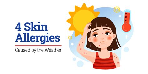 4 Skin Allergies Caused by the Weather | Makati Med