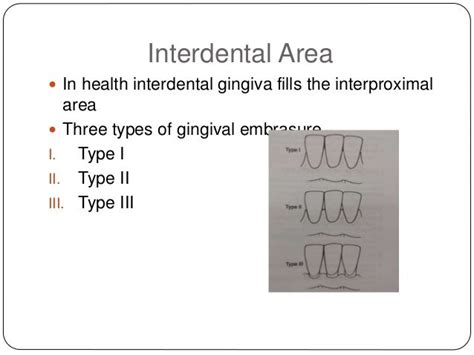 Interdental aids powerpoint presentation