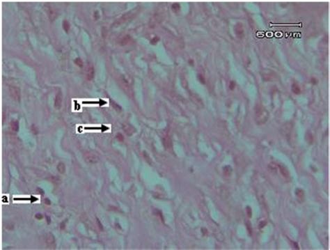 Histology of the granulation tissue obtained from the test group rats... | Download Scientific ...