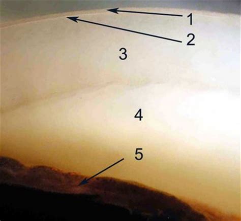 ANATOMY OF THE HUMAN EYE: Cornea Histology