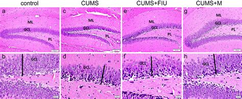 The dentate gyrus of the hippocampus of the control (a, b), CUMS (c,... | Download Scientific ...